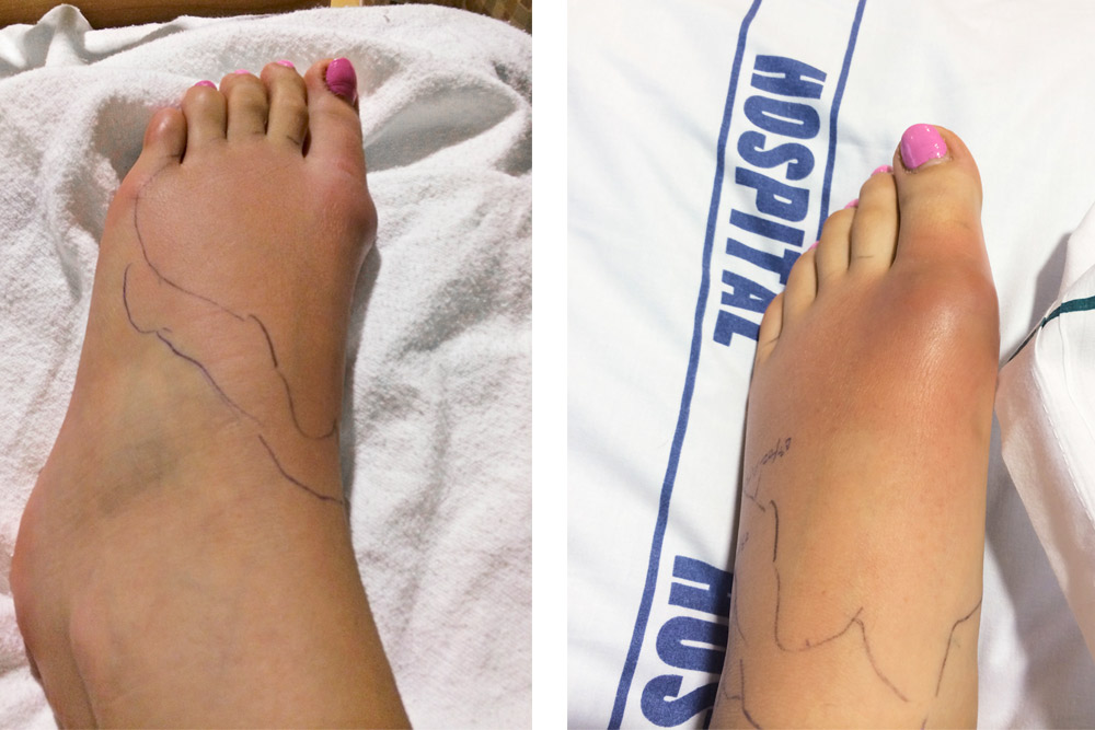My Left Foot: Sarah Mitchell